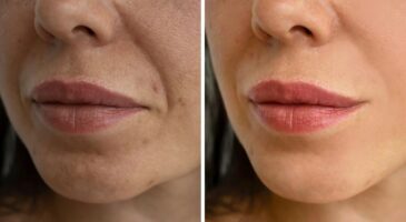 J'ai testé : mon avis sincère sur la crème Nivea Q10 anti-rides à l'acide hyaluronique notée 4,5/5 par les clientes