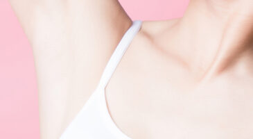 Epilation définitive au laser ou à la lumière pulsée : mode d'