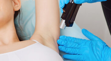 Epilation définitive : quelle méthode choisir ? 