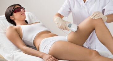 Epilation laser : fonctionnement, avantages et inconvénients