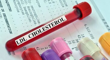 Cholestérol : quel est le taux normal selon l'âge et le sexe ?