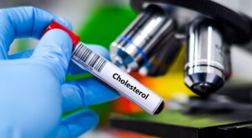 Comment faire baisser son taux de cholestérol sans médicament ? Un médecin répond